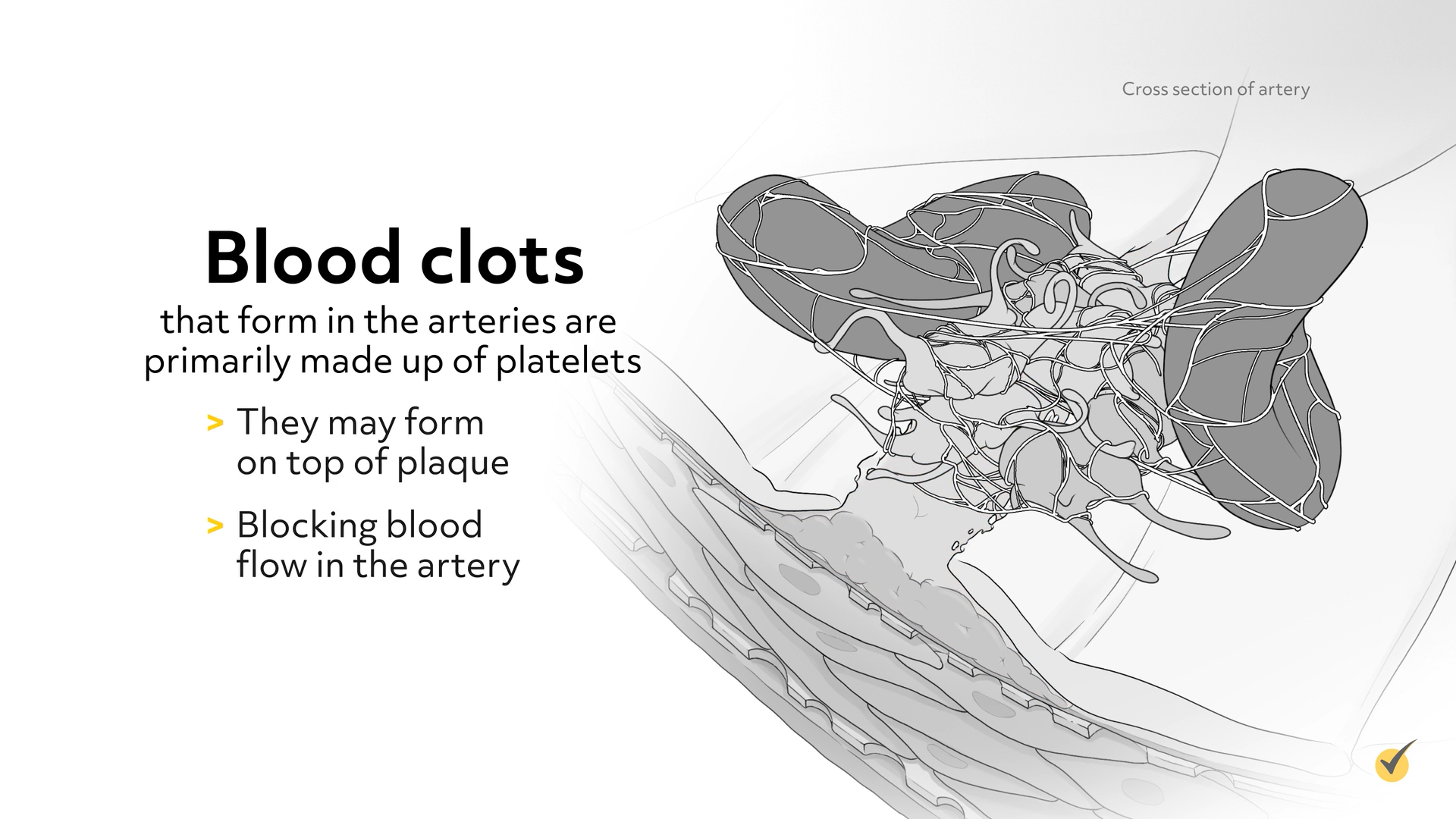 blood clots