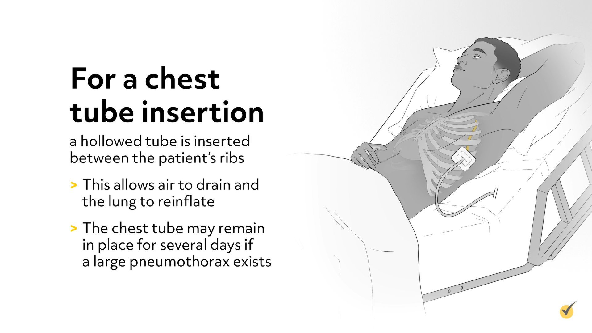 chest tube insertion for pneumothorax