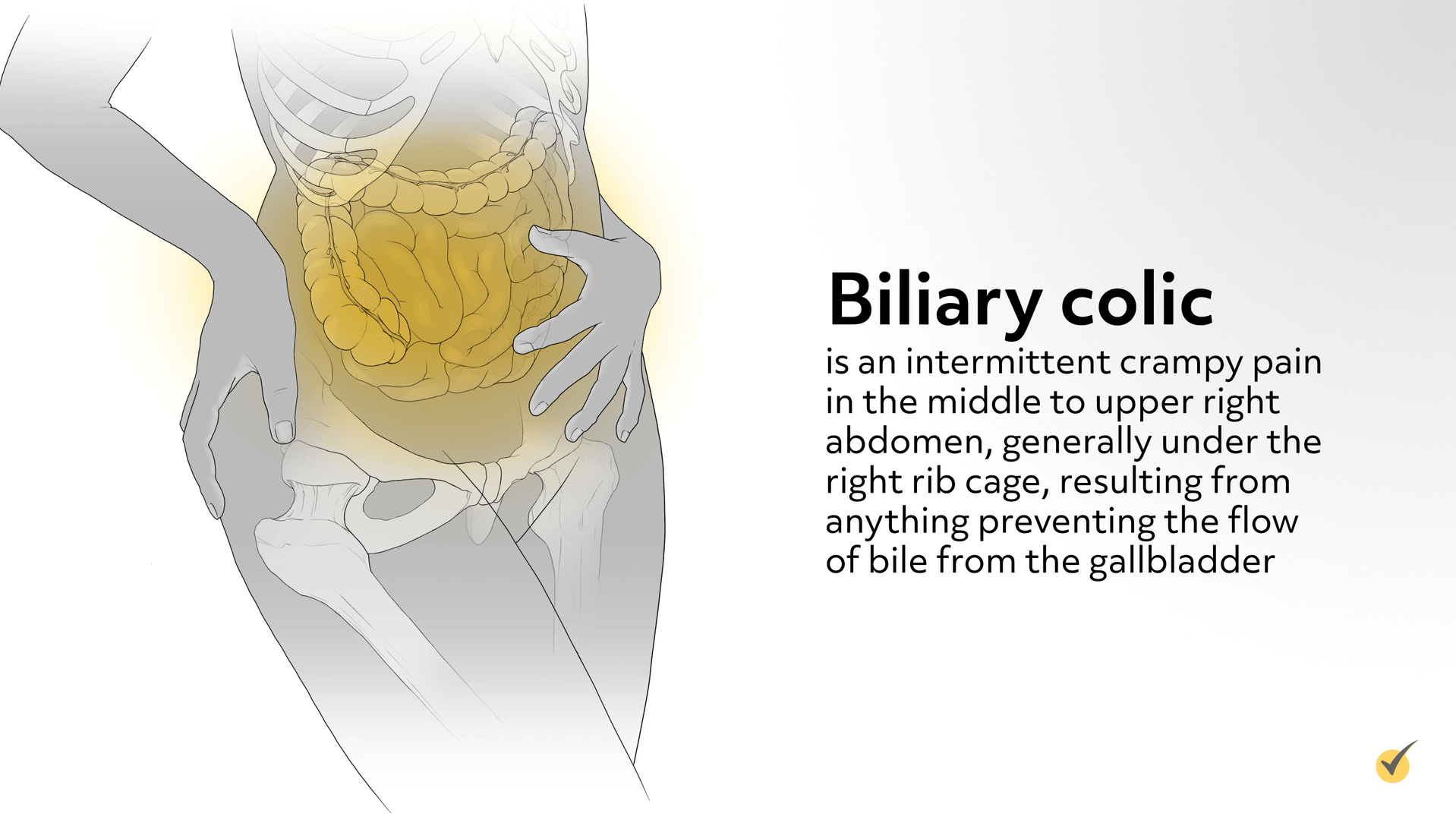 Severe colicky cheap abdominal pain