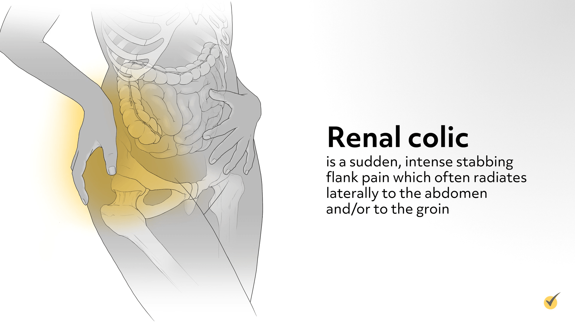 Colic store pain treatment