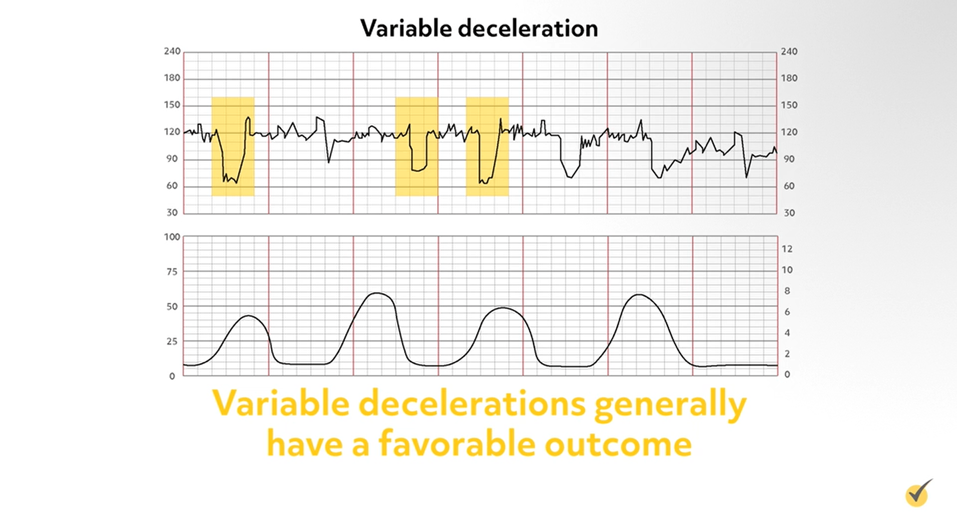 Marked Fetal Heart Rate Variability Indicates - Printable Templates Protal