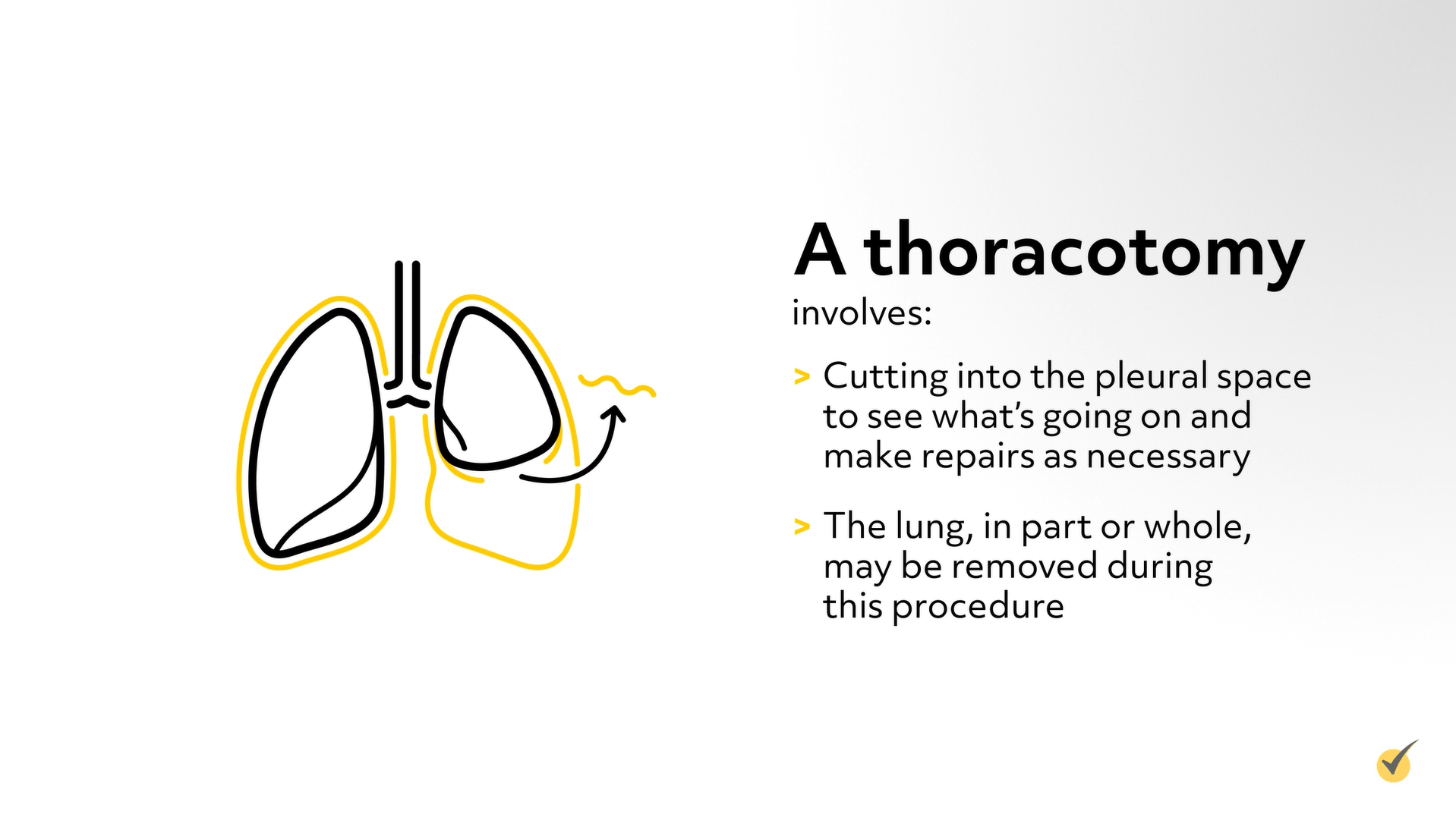 thoracotomy