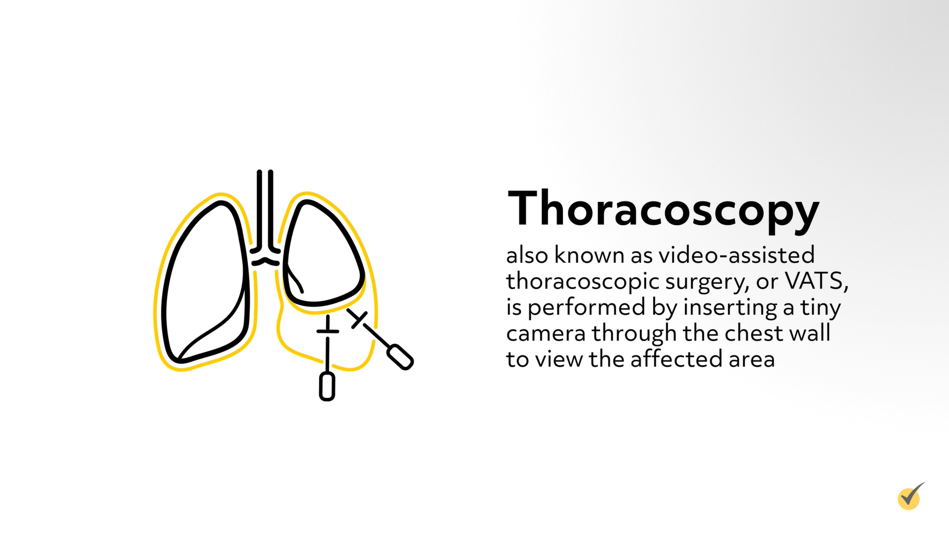 thoracoscopy