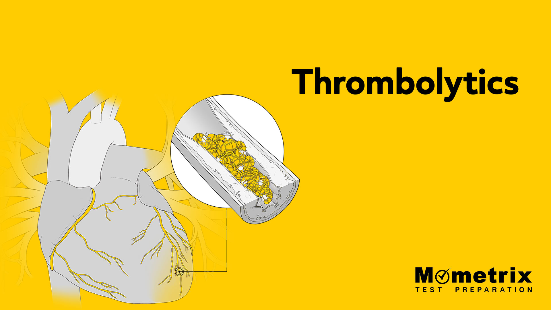 Thrombolytics [Video]