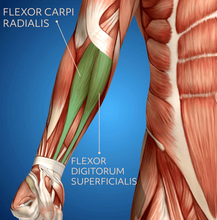 An illustration of the forearm muscles, with the flexor carpi radialis and the flexor digitorum superficialis labeled.