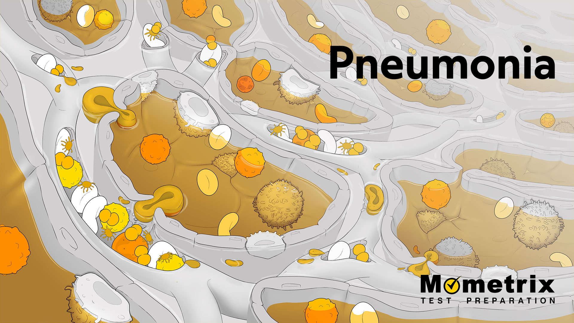 Pneumonia [Video]