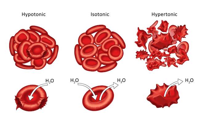 Blood cells in a hypotonic, isotonic, and hypertonic solution