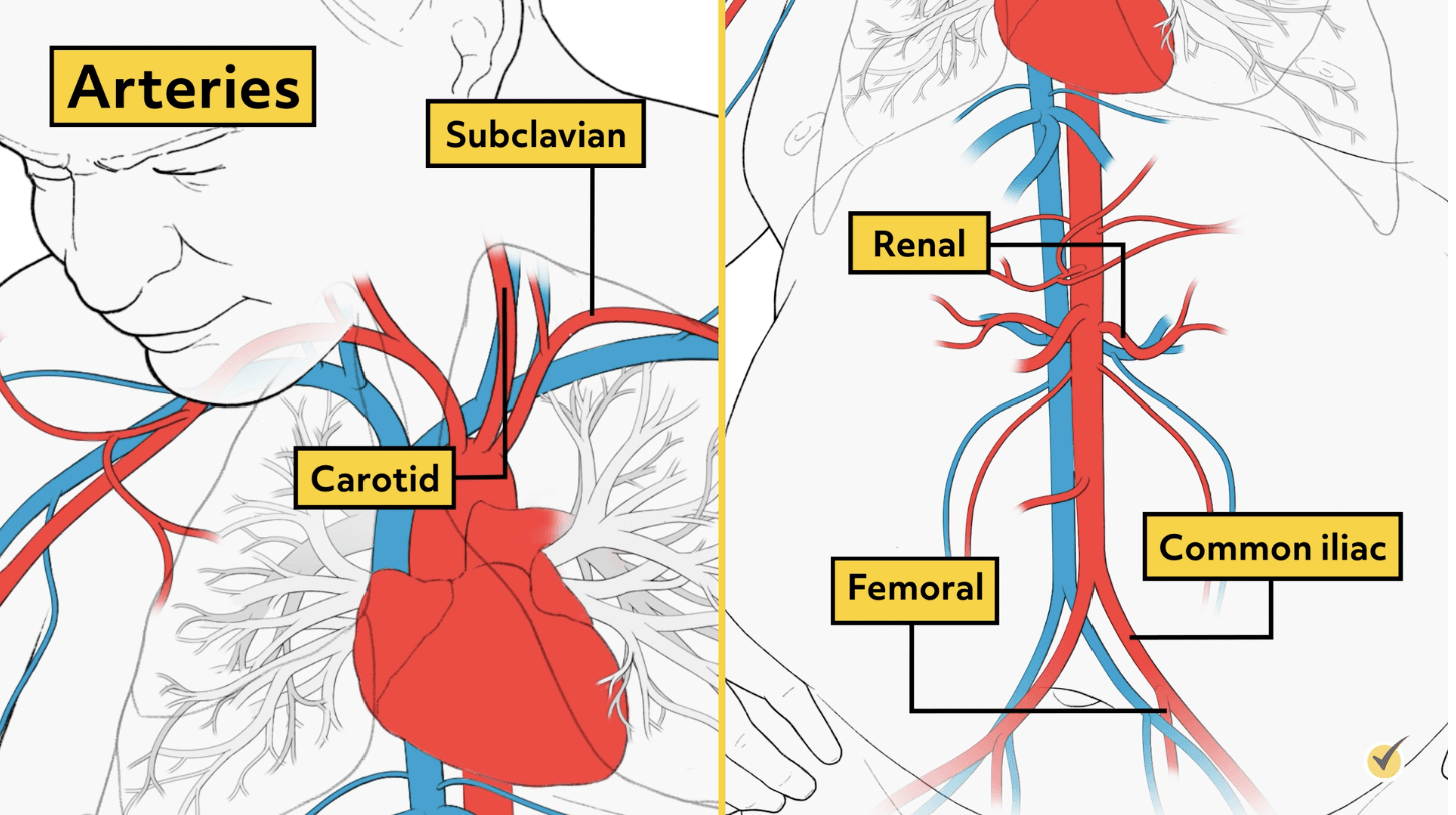 Diagram of different arteries