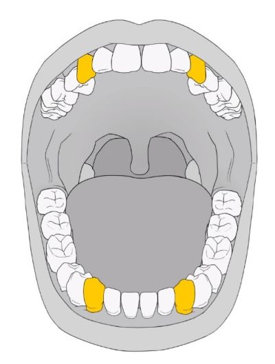 premolar teeth diagram