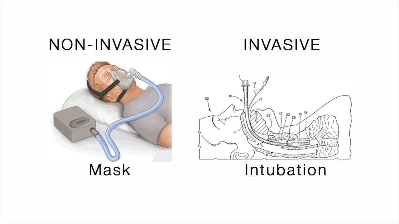 Illustration comparing non-invasive ventilation via face mask and invasive ventilation via intubation, showing equipment and positioning for each method.