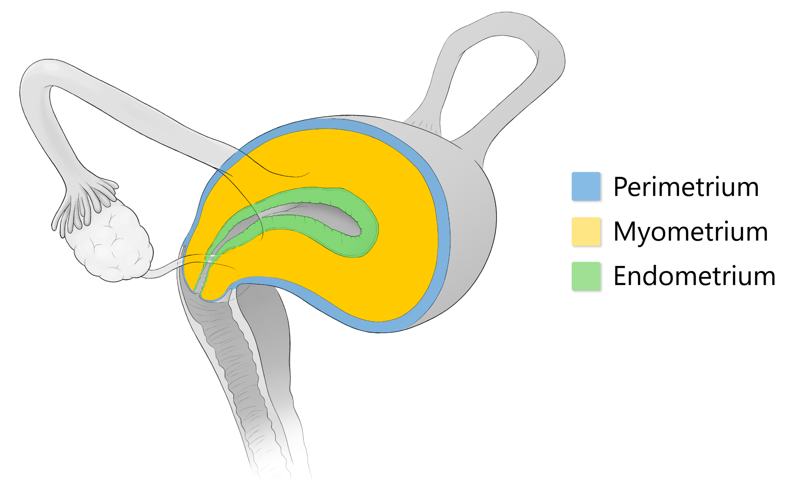 Cross-section diagram of a uterus highlighting the perimetrium (blue), myometrium (yellow), and endometrium (green) layers with a color-coded legend.